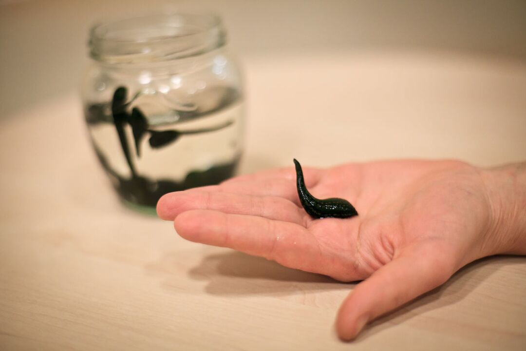 Leeches will serve as raw materials for the production of a cream that stimulates penis growth
